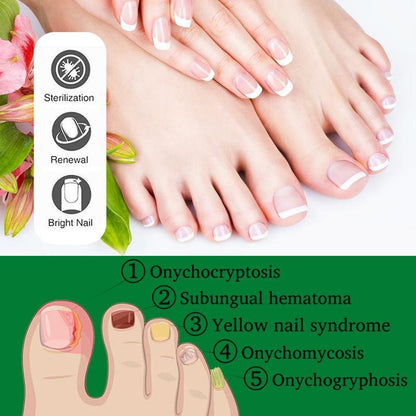 Nail Care Serum Treats fungus, for nail care, exclusive offers, supports recovery from onychomycosis and paronychia