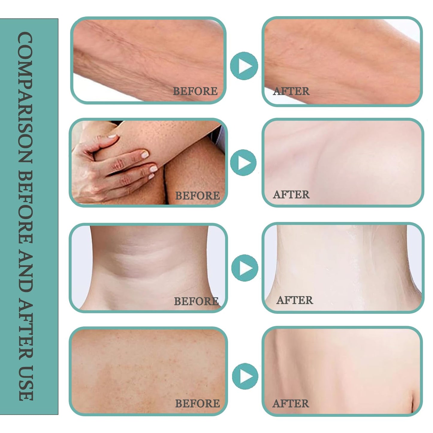 💆‍♀️ Experience Ultimate Luxury - 50% OFF - ✨ - Champagne Lift Hydrating Firming Body Cream