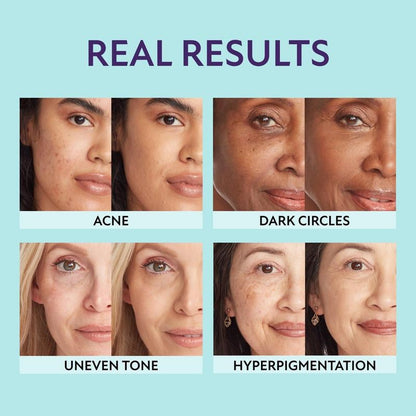 Supreme Crème - 🎉All-in-one Moisturizer, Concealer & Coverage 💧✨ Lightweight & Waterproof