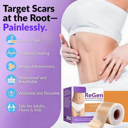 Offizieller Shop: ReGen Microneedles Pro Patches mit Hyaluronsäure-Nano-Heal-Behandlung für neue und alte Narben, Reduzierung von Operationsnarben, Dehnungsstreifen, Keloiden, Akne, Verbrennungen, Warzen, Dermatomen und Krampfadern