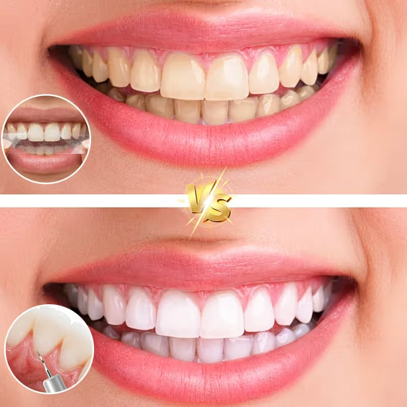 😁Ultrasonic Teeth Whitening Cleaner Set