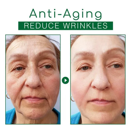 🔥Hot Sale🎁30 Day Anti-Aging Treatment Serum