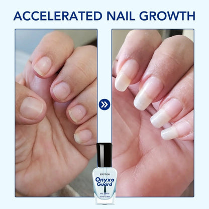 OnyxoGuard Nagelwachstums- und Reparaturserum