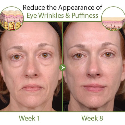🔥Hot Sale🎁30 Day Anti-Aging Treatment Serum