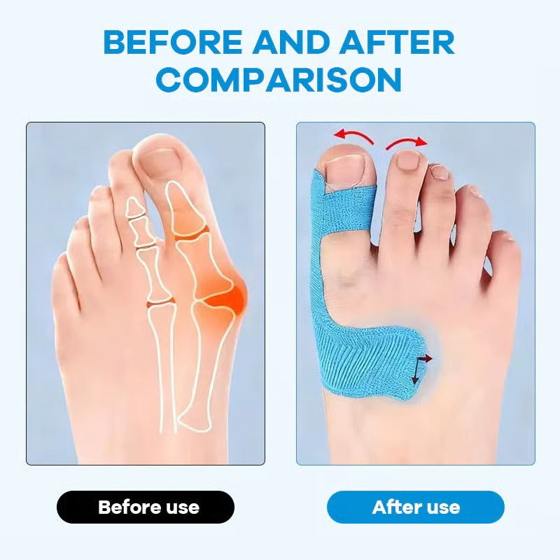 🔥LAST DAY 50% OFF - 👣Pre-cut Hallux Valgus Corrector Kinesiology Tape -Bestseller