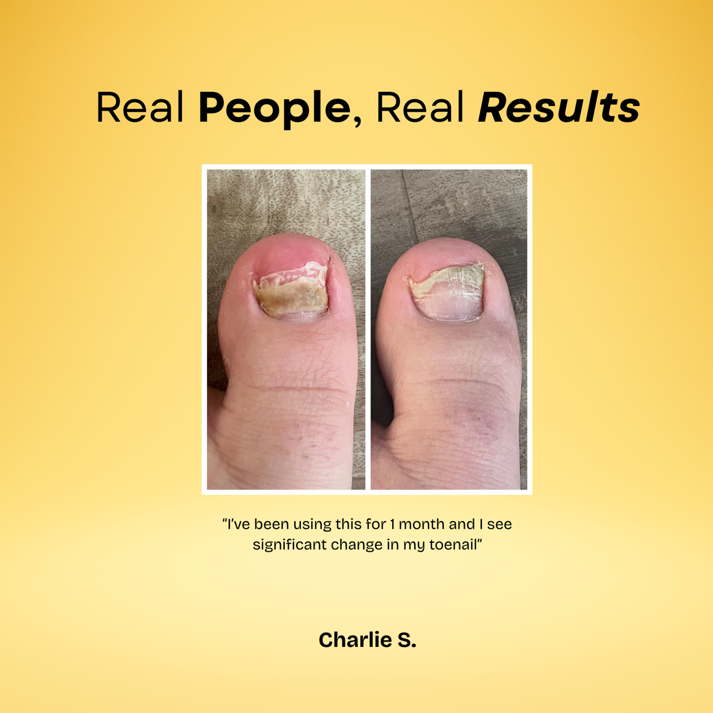 7 Day Nail Treatment