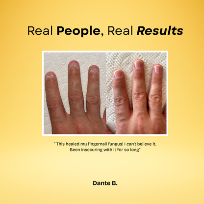 7 Day Nail Treatment